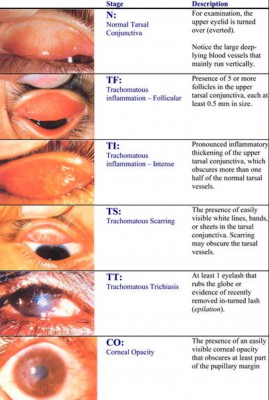 trachoma3.jpeg