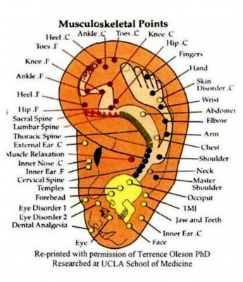 auriculotherapy-pic.jpg